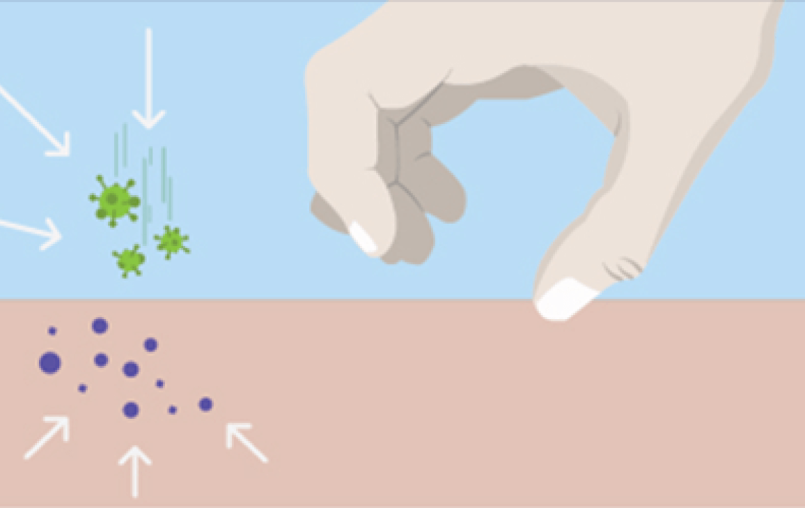 illustration showing immune cells sending inflammatory signals to the surface of the skin causing itch